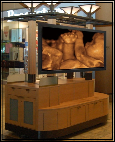 Photo of mall kiosk after adding ultrasound video screens